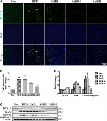 Salvianolic Acid B Protects Against Fatty Acid-Induced Renal Tubular Injury via Inhibition of Endoplasmic Reticulum Stress